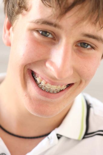 Teenager mit Brackets